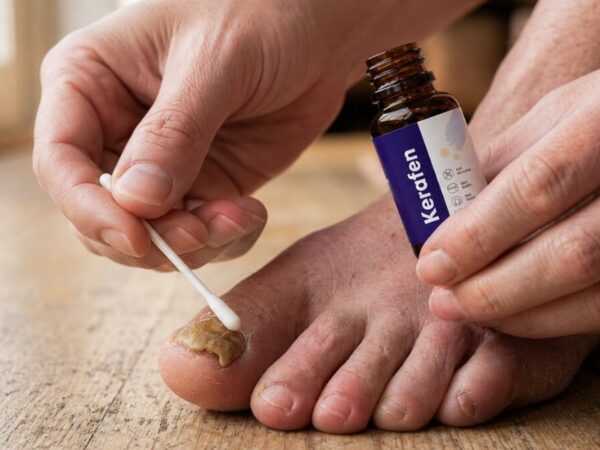 kerafen topical liquid application cotton