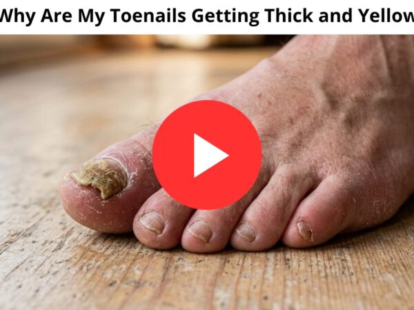 Why Are My Toenails Getting Thick and Yellow